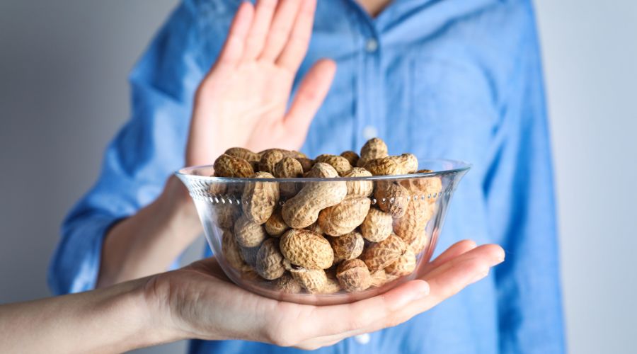 Food allergy - nuts