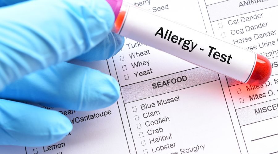 Food allergy test